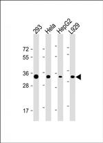 STUB1 Monoclonal Antibody (1008CT12.4.1)