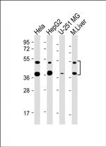 FDPS Monoclonal Antibody (1049CT13.1.4)