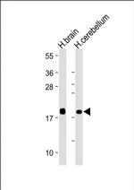 VSNL1 Monoclonal Antibody (1831CT148.68.34)