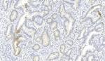 ROS1 Monoclonal Antibody (1843CT776.78.21)