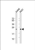 RAB29 Monoclonal Antibody (1789CT823.71.1.1)