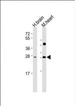 DKK2 Monoclonal Antibody (1833CT856.7.20)