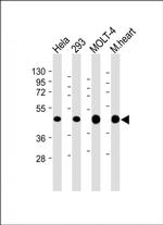 MTHFD2 Monoclonal Antibody (1985CT220.118.31)