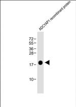 PACAP Monoclonal Antibody (1996CT329.45.62)