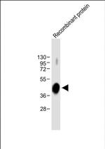 ADAMTS4 Monoclonal Antibody (1995CT113.89.78)