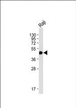 HLA-F Antibody in Western Blot (WB)