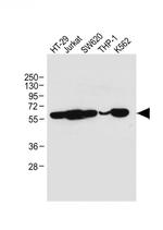 RIP3 Monoclonal Antibody (2013CT892.86.49)
