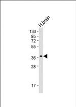 GDE1 Monoclonal Antibody (2021CT823.61.7)