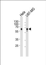 GPR56 Monoclonal Antibody (1443CT642.85.27)
