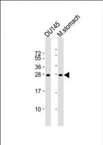 RAB27B Monoclonal Antibody (1596CT245.254.49)