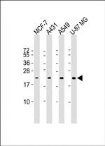 RAB13 Monoclonal Antibody (1600CT724.2.34)