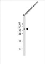 FAT4 Monoclonal Antibody (1654CT892.85.3)