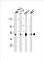 PLOD1 Monoclonal Antibody (2114CT109.4.71.73)