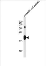 PNOC Monoclonal Antibody (2133CT1268.37.7)