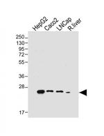 GSTA1 Monoclonal Antibody (2128CT386.77.4)