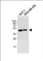 SULT2B1 Monoclonal Antibody (2142CT1553.26.63)