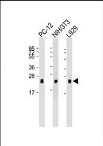 RhoA Monoclonal Antibody (2148CT124.4.9)