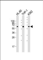 CARD9 Monoclonal Antibody (2156CT20.4.85)