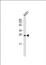 Calpain S1 Monoclonal Antibody (2190CT339.12.2)