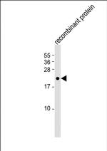 FGF4 Monoclonal Antibody (2188CT10.1.4)