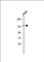 DAPK1 Monoclonal Antibody (2196CT239.5.2)