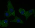 CEACAM6 Antibody in Immunocytochemistry (ICC/IF)