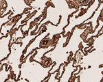 CEACAM6 Antibody in Immunohistochemistry (Paraffin) (IHC (P))