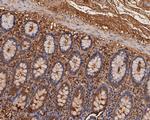 CEACAM6 Antibody in Immunohistochemistry (Paraffin) (IHC (P))