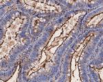 CEACAM6 Antibody in Immunohistochemistry (Paraffin) (IHC (P))