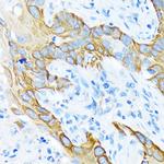 Cytokeratin 4 Antibody in Immunohistochemistry (Paraffin) (IHC (P))