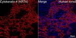 Cytokeratin 4 Recombinant Rabbit Monoclonal Antibody (6H9R6)