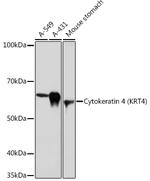 Cytokeratin 4 Antibody in Western Blot (WB)