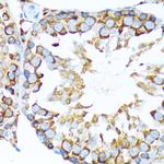 STIP1 Antibody in Immunohistochemistry (Paraffin) (IHC (P))