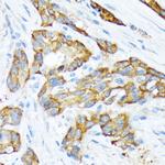 STIP1 Antibody in Immunohistochemistry (Paraffin) (IHC (P))