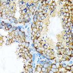STIP1 Antibody in Immunohistochemistry (Paraffin) (IHC (P))