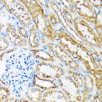 MSP Recombinant Rabbit Monoclonal Antibody (5R7X2)