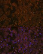 MSP Antibody in Immunohistochemistry (Paraffin) (IHC (P))
