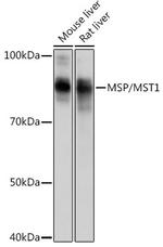 MSP Antibody in Western Blot (WB)