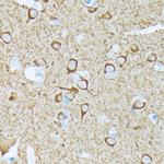 CaMKII Pan Antibody in Immunohistochemistry (Paraffin) (IHC (P))