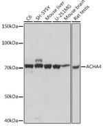 CHRNA4 Recombinant Rabbit Monoclonal Antibody (1C2H2)