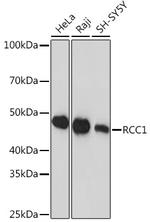 RCC1 Antibody in Western Blot (WB)