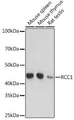RCC1 Antibody in Western Blot (WB)