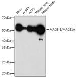 MAGE1 Recombinant Rabbit Monoclonal Antibody (9Y6K1)