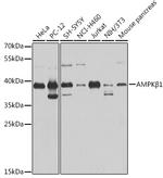 AMPK beta-1 Antibody in Western Blot (WB)