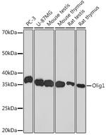 OLIG1 Recombinant Rabbit Monoclonal Antibody (7E4B2)