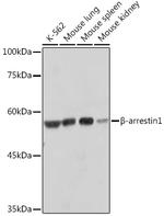 beta Arrestin 1 Recombinant Rabbit Monoclonal Antibody (F7C2)