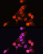 p16INK4a Recombinant Rabbit Monoclonal Antibody (0D0C8)