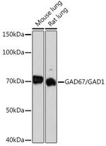 GAD67 Recombinant Rabbit Monoclonal Antibody (4I8S8)