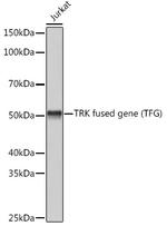 TRK fused gene Antibody in Western Blot (WB)
