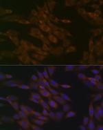 TIMM50 Recombinant Rabbit Monoclonal Antibody (0W6J4)